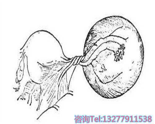 如何预防女宝宝的几种阴道炎