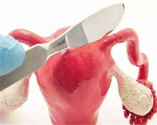 解析广州试管助孕生殖的成功关键要素