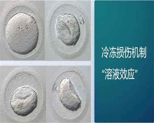 广州试管婴儿医院探寻：专业供卵与辅助生殖技术解析