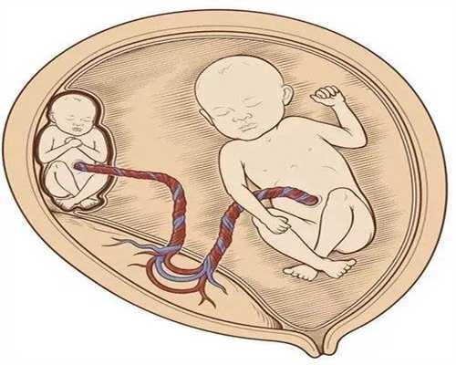 广东广州试管婴儿成功率如何？科学备孕助您好孕